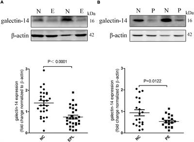 Galectin-14 Promotes Trophoblast Migration and Invasion by Upregulating the Expression of MMP-9 and N-Cadherin